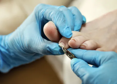 foot care trimming nails